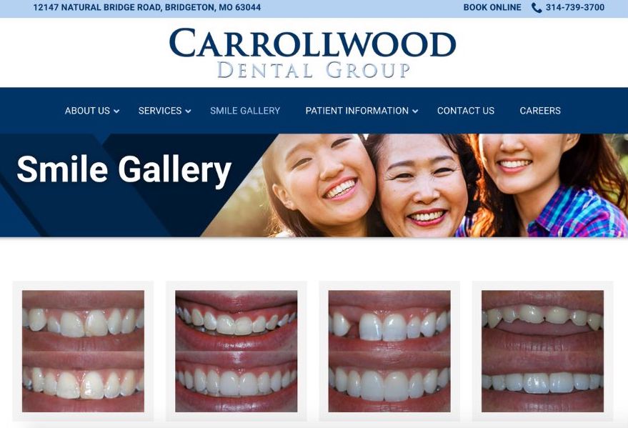 dental marketing - smile gallery example on website